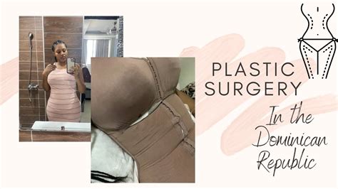 Dominican republic plastic surgery bbl. Things To Know About Dominican republic plastic surgery bbl. 